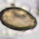 Egg of a Chinese liver luke found in an ancient toilet, because science. (Image: The Journal of Archaeological Science)